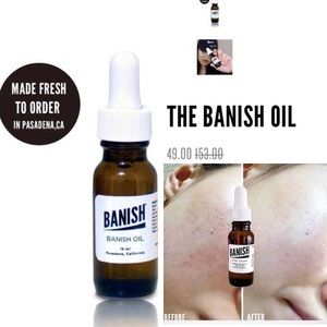 Banish Oil from Banish Acne